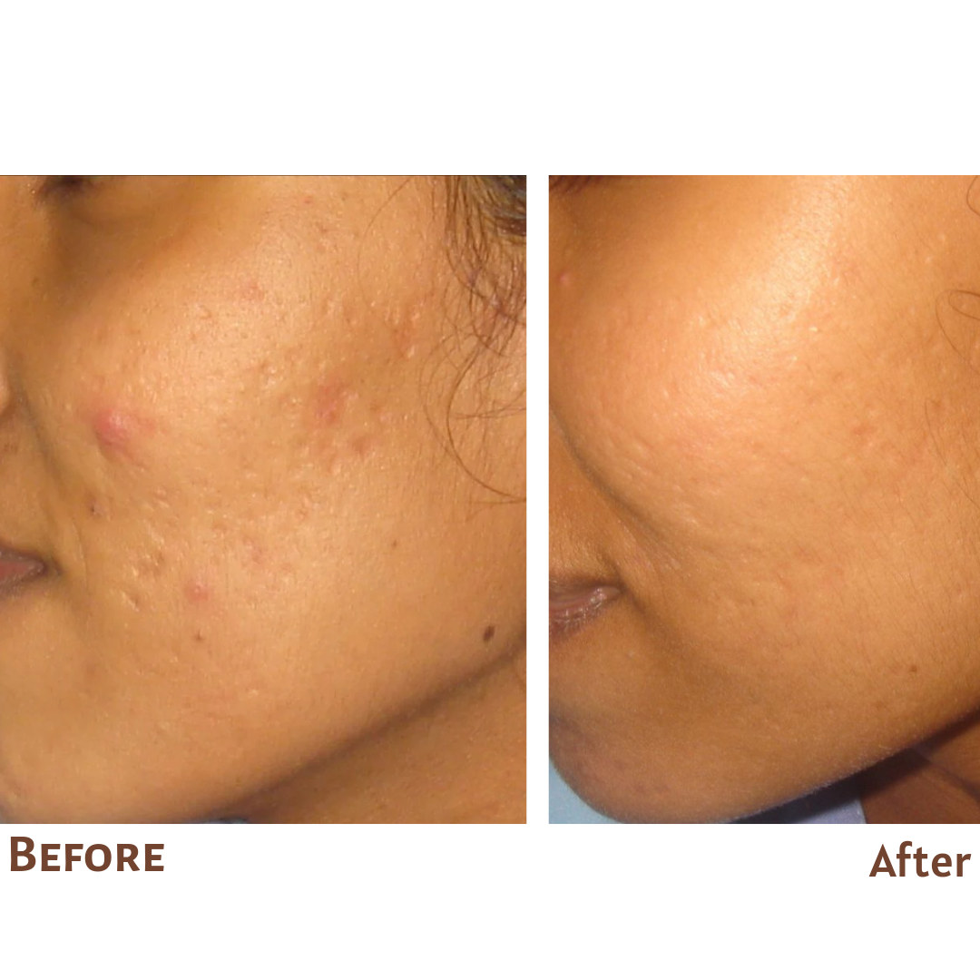 skin whitening treatment sri lanka