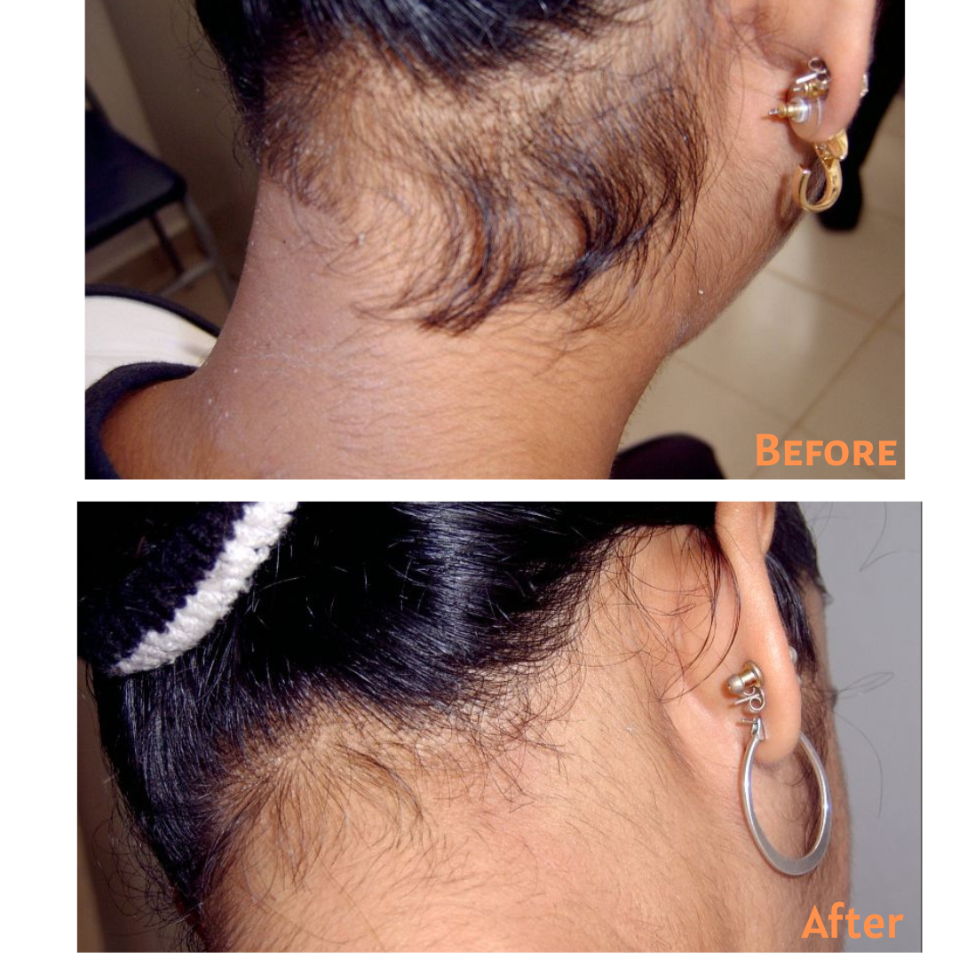 best skin specialist in sri lanka